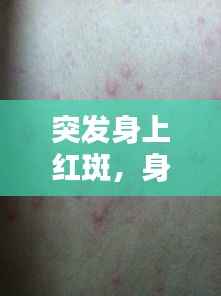 突发身上红斑,身上突现红斑是什么原因