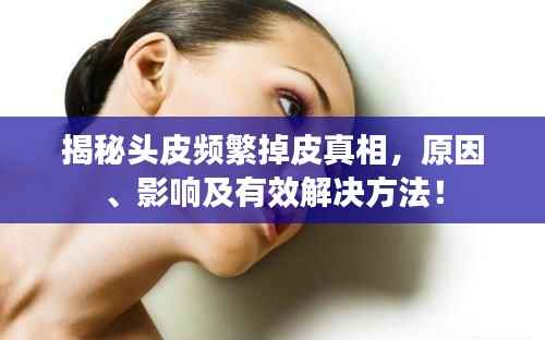 揭秘头皮频繁掉皮真相,原因、影响及有效解决方法!