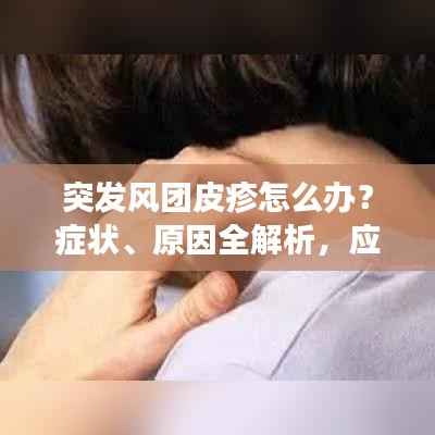 突发风团皮疹怎么办？症状、原因全解析，应对之策一网打尽！